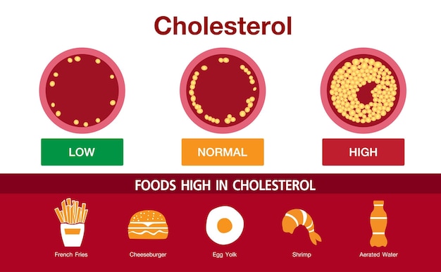 Diseño de vectores de riesgo para la salud arterial de alimentos ricos en colesterol