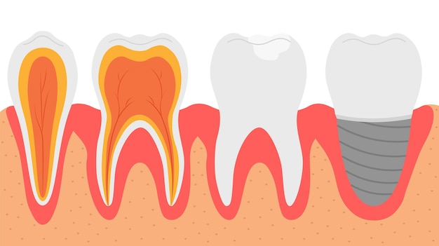 Vector diversos tipos de ilustración de vector de dientes