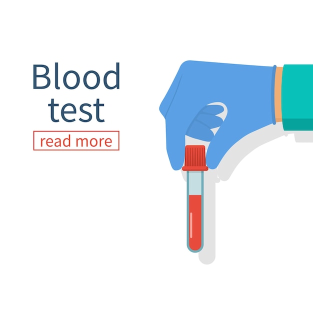 Vector doctor sostenga la muestra de sangre de la mano en el tubo de ensayo aislado antecedentes médicos investigación de laboratorio diseño plano de ilustración vectorial equipo para análisis donación de sangre