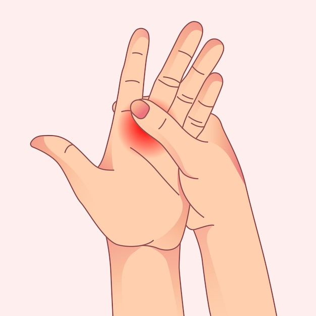 Dolor agudo en la mano Artritis y problemas de tendones fracturas Túnel carpiano en dolor de mano
