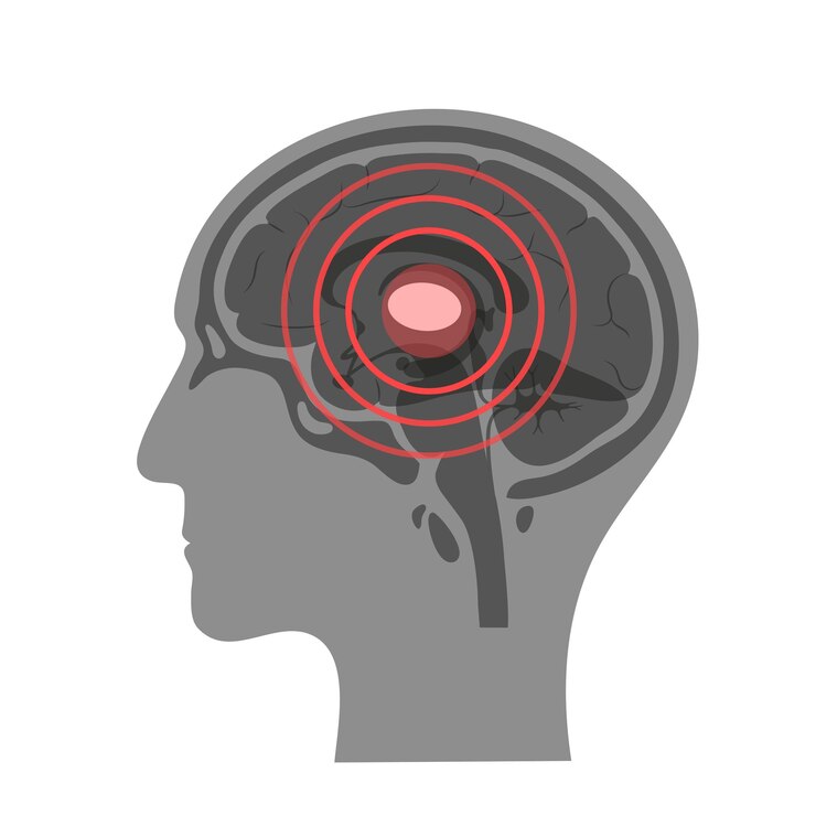 Vector dolor, cerebro, ilustración