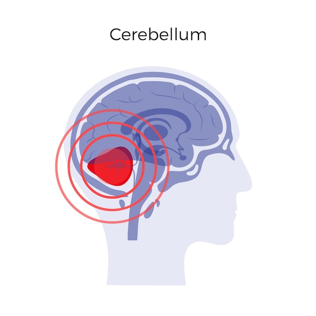 dolor, cerebro, ilustración