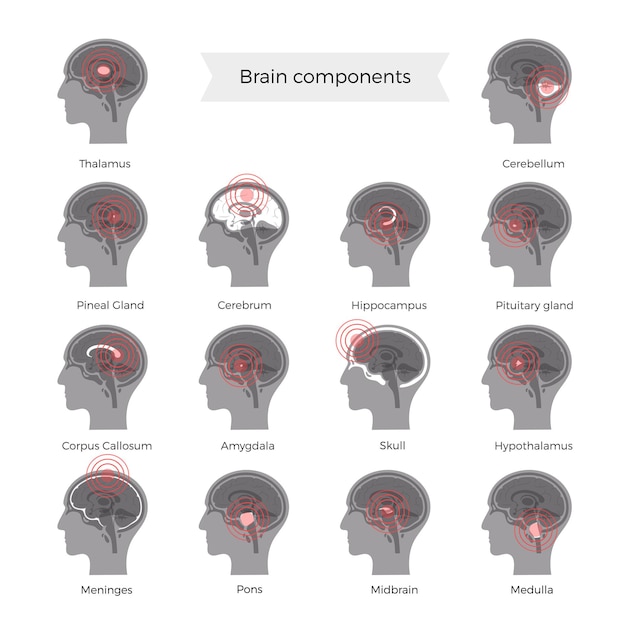 Dolor, cerebro, ilustración