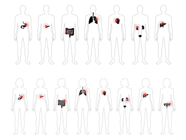 Dolor en el cuerpo humano