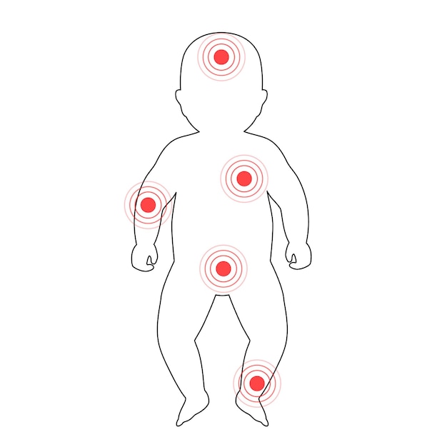 Dolor en el cuerpo humano