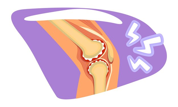 Vector dolor de rodilla 2d vector ilustración aislada