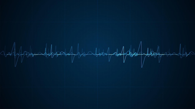 Ecualizador digital azul abstracto Fondo de onda de sonido