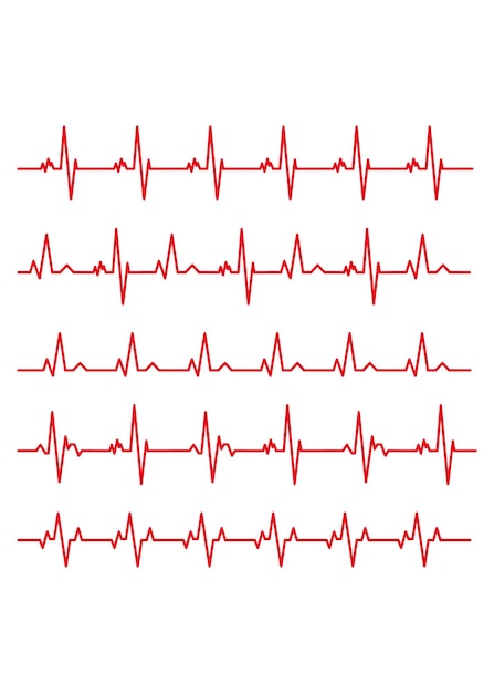 Electrocardiograma Conjunto de materiales para ilustrar el ritmo de la línea