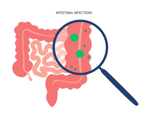 Enfermedad de infecciones intestinales