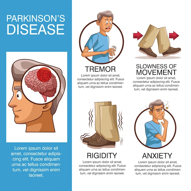 Vector enfermedad de parkinson infografía