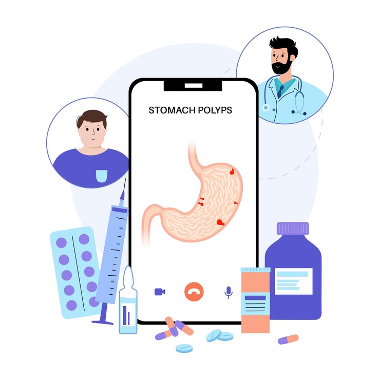 Vector enfermedad de los pólipos estomacales