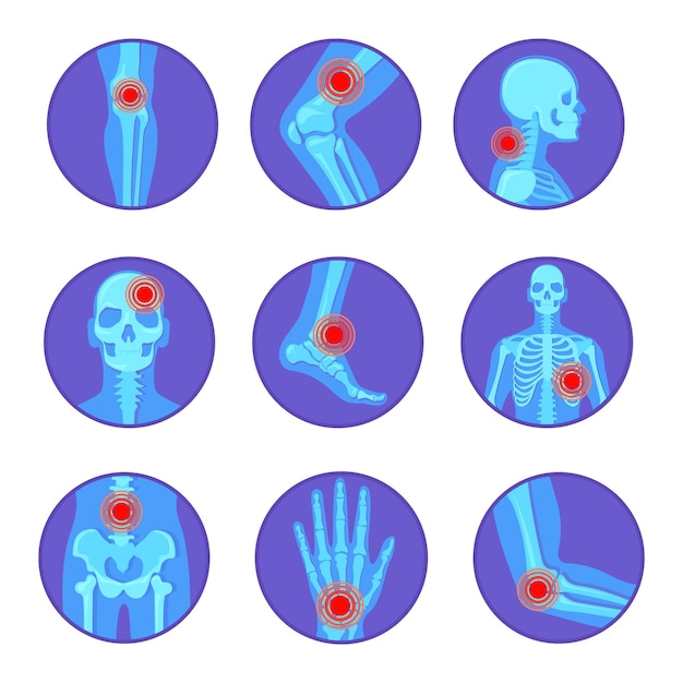 Enfermedades articulares ortopédicas Dolor reumatoide hueso rodilla mano codo artritis reumatología esqueleto humano cuerpo rayos x medicina cirugía pie cráneo pelvis dibujos animados vector ordenado ilustración