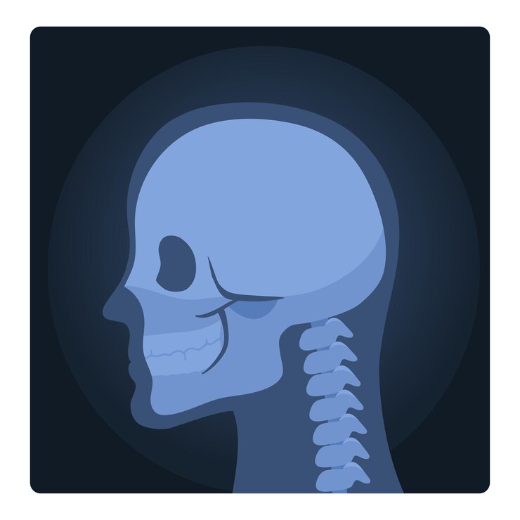 Vector escáner médico de rayos x de la cabeza humana