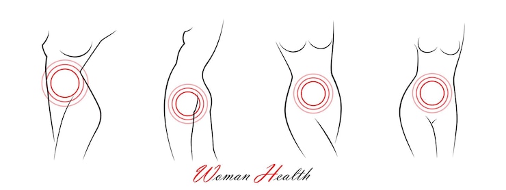 Vector establecer siluetas de mujer elegante estilo de dibujo lineal corrección del cuerpo de la mujer ayuda concepto de cirugía plástica