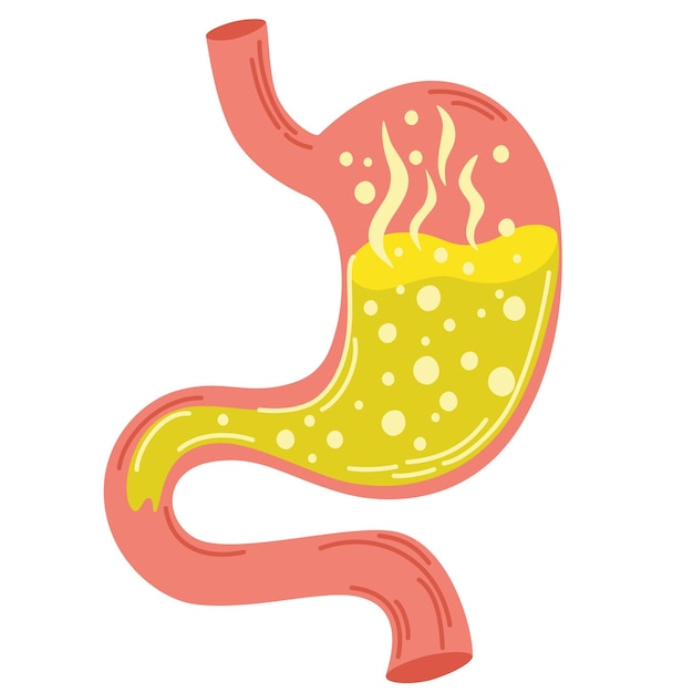 Vector estómago humano gastritis y reflujo ácido indigestión vómitos acidez estomacal y problemas de dolor de estómago concepto estomacal no saludable acidez estomacal malestar dolor ilustración vectorial plana