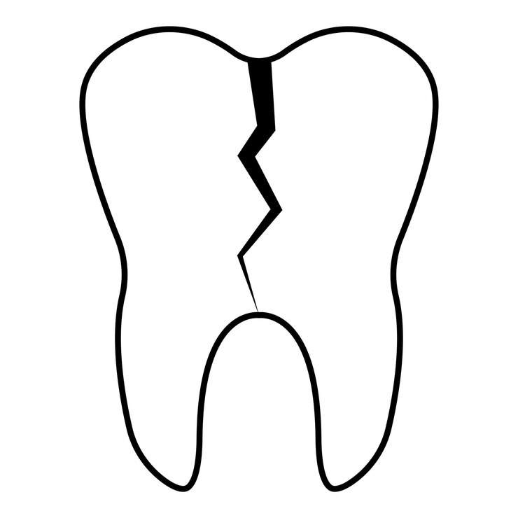 Vector fractura de la fisura de los dientes, cavidad cáriosa de los dientes blanco de dibujos animados, abolladura de la salud
