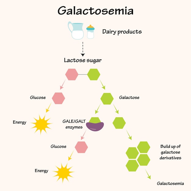 Vector galactosemia