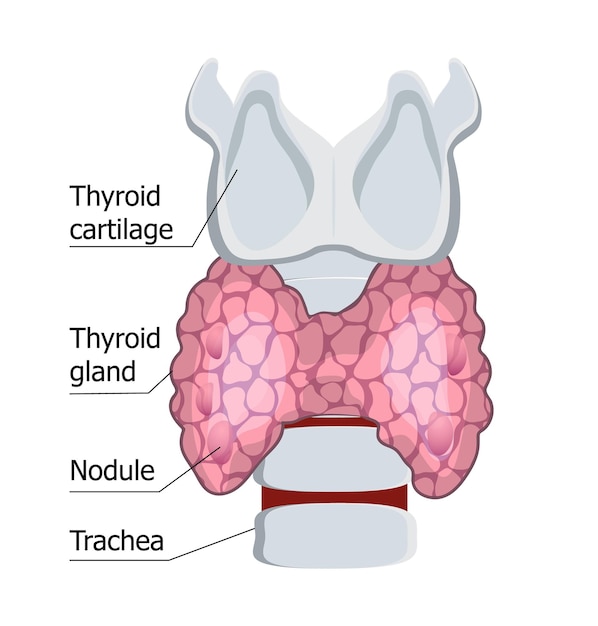 Glándula tiroides humana aislada en el vector de concepto de hipotiroidismo de fondo blanco