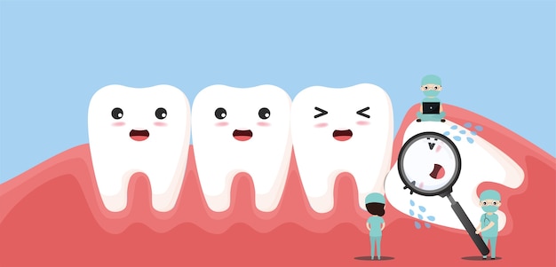 Grupo de pequeños dentistas están cuidando un diente grande. carácter de la muela del juicio impactada empujando los dientes adyacentes causando inflamación, dolor de muelas, dolor de encías.