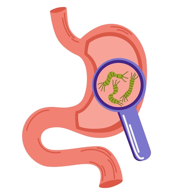 Helicobacter Pylori en el estómago Bacterias bajo lupa Enfermedades estomacales Concepto estomacal no saludable Acidez estomacal malestar dolor Ilustración vectorial plana aislada en blanco