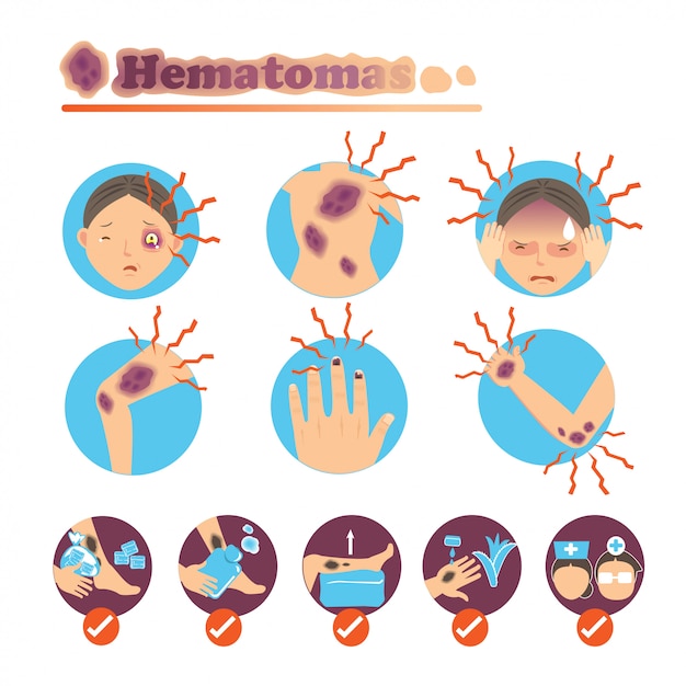 Vector hematomas en conjunto de círculo.