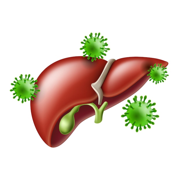 Hepatitis Hígado humano con infección viral virus hepatitis
