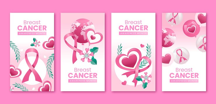 Historias de Instagram para concienciar sobre el cáncer de mama