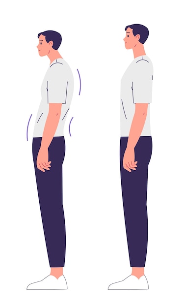 Vector hombre con mala postura y postura correcta escoliosis de curvatura espinal
