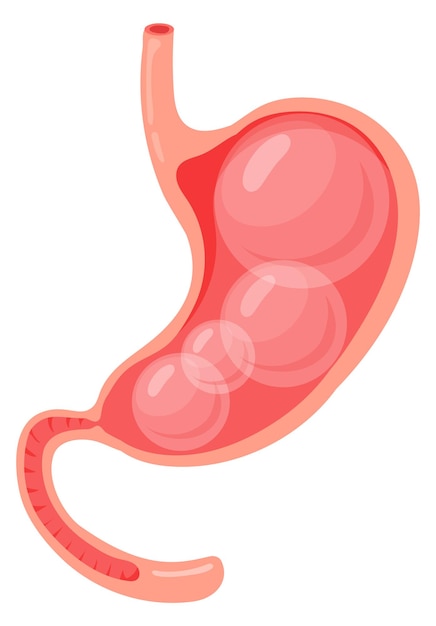 Icono de dibujos animados de estómago hinchado Problema del sistema digestivo