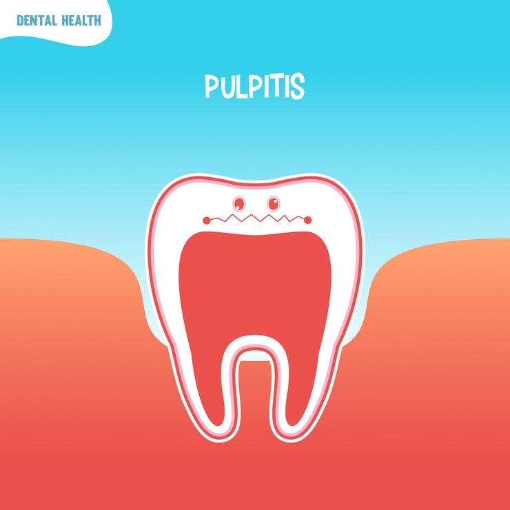 Vector icono de diente malo de dibujos animados con pulpitis