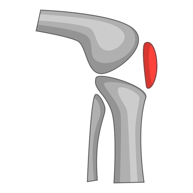 Icono de implante de reemplazo de rodilla Ilustración de dibujos animados de icono de vector de implante de reemplazo de rodilla para web