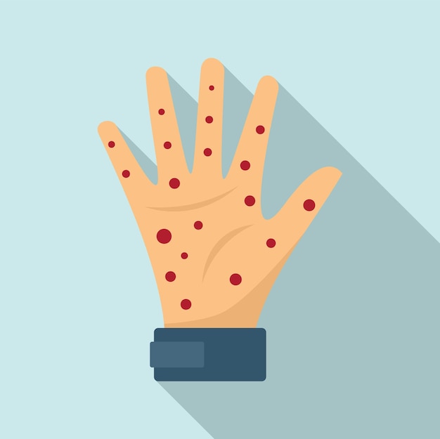 Icono de sarampión de mano Ilustración plana del icono de vector de sarampión de mano para diseño web