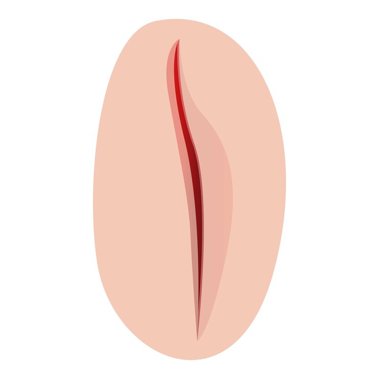 Vector icono de sutura médica del bisturí icono vectorial de sutura sanitaria del bisturín para el diseño web aislado sobre fondo blanco