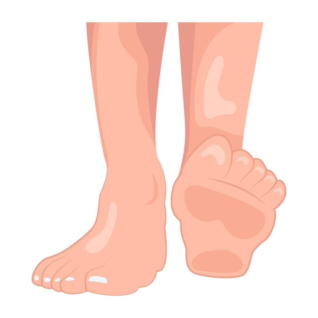 Iconos de las damas con los pies planos
