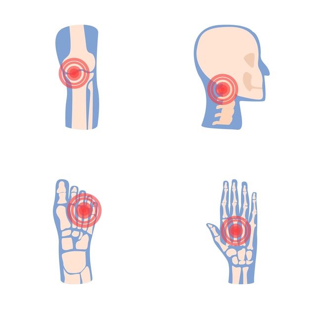 Iconos de enfermedades articulares conjuntos vector de dibujos animados articulación humana con anillo de dolor rojo