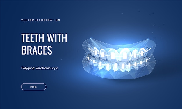 Ilustración de aparatos dentales en estilo poligonal futurista