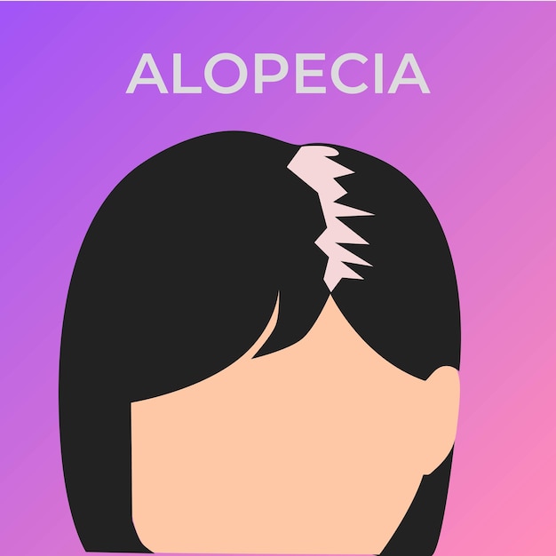 Ilustración de la cabeza de una mujer afectada por alopecia estilo de dibujos animados y fondo de gradiente púrpura