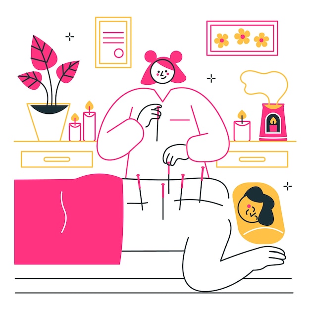 Ilustración del concepto de acupuntura
