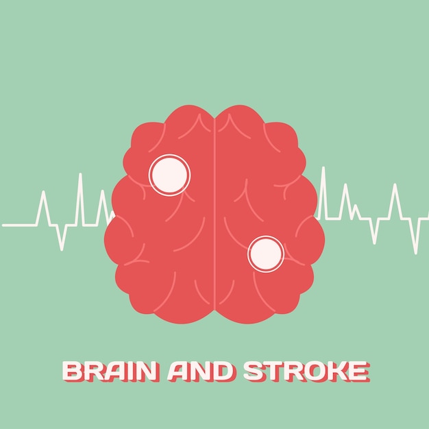 Ilustración del concepto de cerebro y accidente cerebrovascular en estilo plano