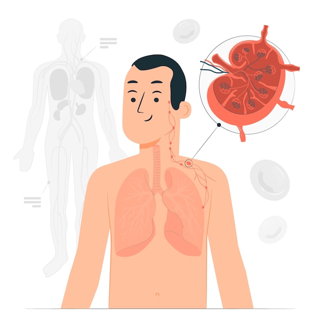 Ilustración del concepto de linfoma