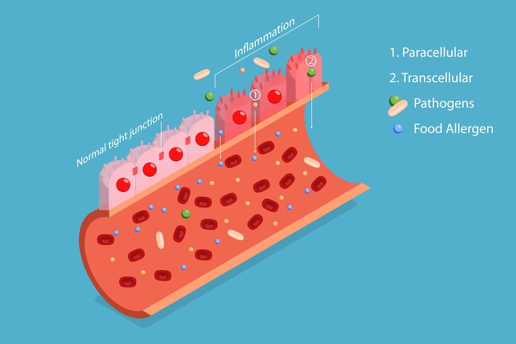 Vector ilustración conceptual de vector plano isométrico 3d del síndrome del intestino permeable