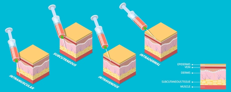 Vector ilustración conceptual de vectores planos isométricos 3d de tipos de inyección