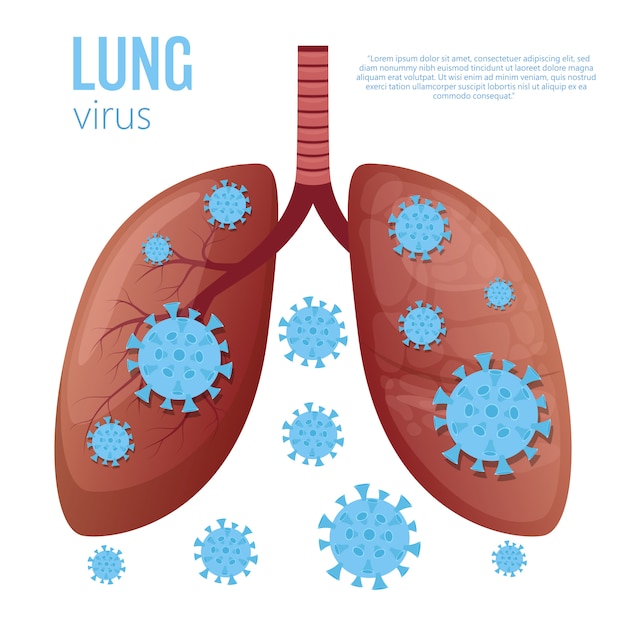 Ilustración de la enfermedad pulmonar sobre fondo blanco