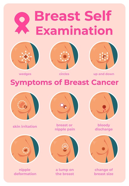 Ilustración de examen de cáncer de mama