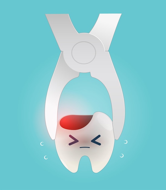Ilustración de extracción de dientes