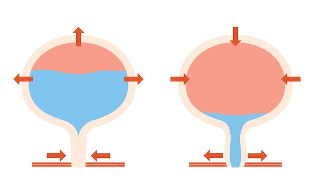 Vector ilustración médica del mecanismo normal de la vejiga para orinar