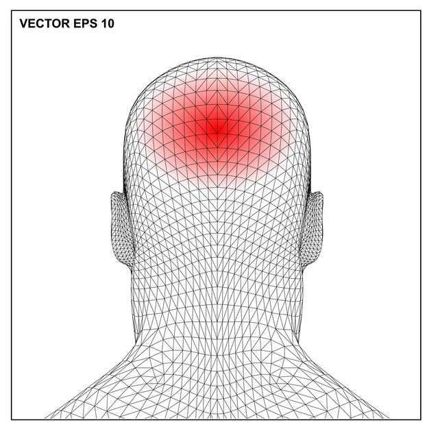 Vector ilustración médica que muestra una inflamación dolorosa