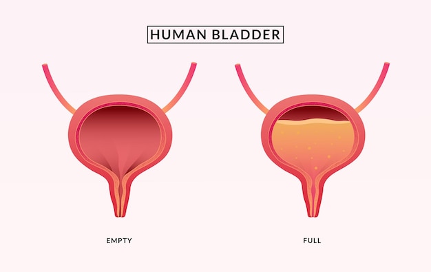 Vector ilustración médica de vejiga urinaria vacía y llena