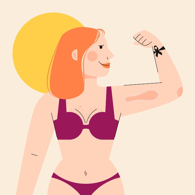 Vector ilustración de melanoma plano dibujado a mano de salud