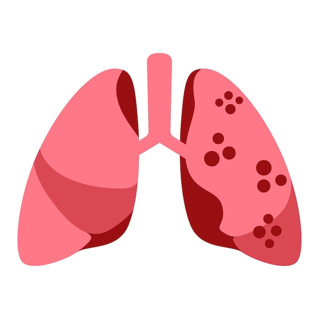 Ilustración plana de la enfermedad pulmonar de la tuberculosis